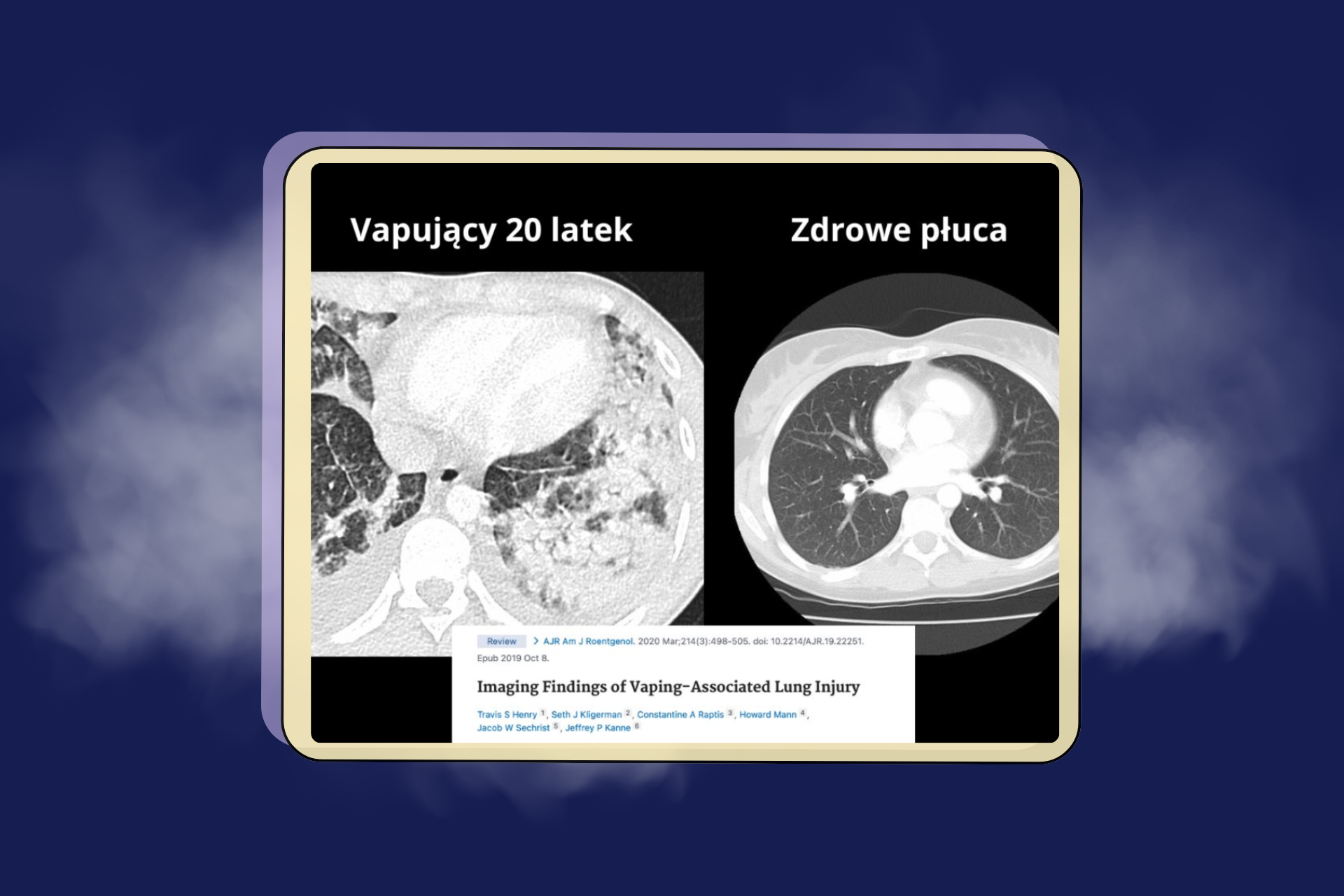 Tradycyjne papierosy kontra e-papierosy – czy można mówić o zdrowszej alternatywie?